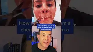 Crazy flaking after chemical peel | 208SkinDoc