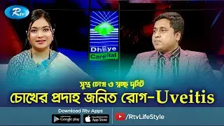চোখের প্রদাহ জনিত রোগ-Uveitis | Sustho Cokh | Uveitis | Rtv Helath Program