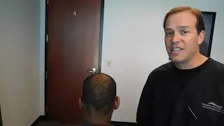 West Palm Beach | Don't Get a FUE Hair Transplant : Get a Scar-less FUT Hair Transplant