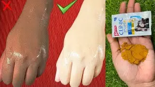 हाथ पैर धोते वक्त शैम्पू में बस ये मिला लो शरीर पर सालों से जमी मैल मिनटों में साफ़ कर गोरा बना देगा