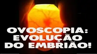 OVOSCOPIA: evolu&ccedil;&atilde;o do embri&atilde;o!