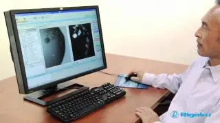 Minstrel DT UV Protein Crystal Imaging system
