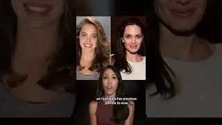Angelina Jolie: What Has She Had Done? 🤔💉✨ #angelinajolie #plasticsurgery #lips