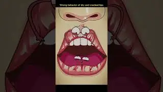 Dry and cracked lips