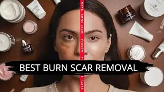 Best Burn Scar Removal Treatments in India - Tested