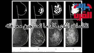 تكلسات الثدي كل ما تحتاجين معرفته