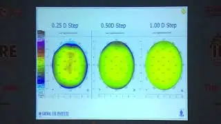 AIOC2019   IC121    Topic   TOPOGRAPHY AND PACHYMETRY   Dr SARTAJ GREWAL