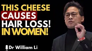 Avoid This Cheese or Lose Hair Fast   Dr William Li