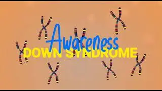 MSJMC celebrates WDSD - a teen with Down Syndrome