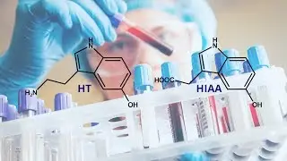 Rapid Detection of the Biomarkers for Carcinoid Tumors by a Lanthanide Metal&ndash;Organic Framework