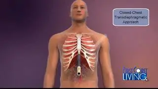 FCL Wednesday May 23rd St. Vincents Medical Center Riverside