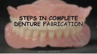 Steps in Complete Denture Fabrication