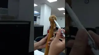 Osso F&ecirc;mur - acidentes anat&ocirc;micos