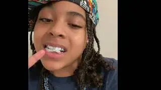 How to fake African American accent with drip & fake teeth..