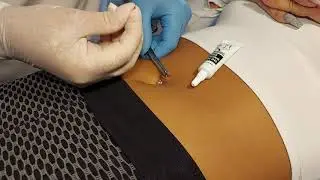 K&ouml;ld&ouml;k piercing szur&aacute;s Tatab&aacute;nya RH piercing szalon