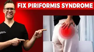 Piriformis Syndrome Won't Go Away? [Stretches I Exercises I Treatment]