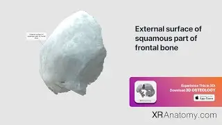 External surface of squamous part of frontal bone