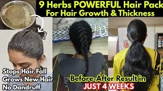 💁‍♀️9 जड़ीबूटियों Ka Magic Hair Pack ✨ | 🌼 बाल झड़ना बंद + बालों की Growth 3X तेज़! | 💯% Natural DIY
