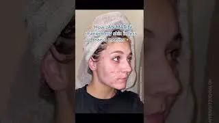 JMSR Consumer Review #SkinbyJMSR #TransformYourSkin