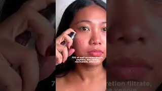 Snail serum that is good for breakouts #benton  #bentoncosmetic #snailmucin