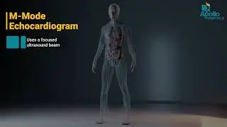 What is an Echocardiogram Test