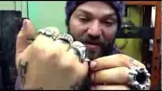 Jackass Bam Margera - smashed rings removal