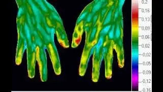 Thermography - based Blood Flow Imaging in hands (endothelial frequency band)