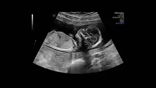 Embryo/Naama Perel Tzadok