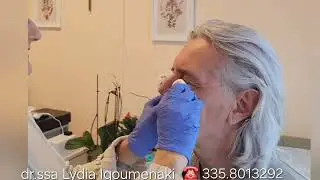 ✅️Addio Macchie e Cheratosi in pochi secondi e senza dolore - Dr.ssa Lydia Igoumenaki - Roma 💯​