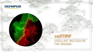 Olympus cellTIRF | Excellent Multicolor TIRF Imaging