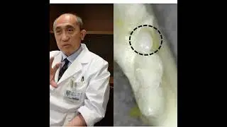In Japan, they learned how to grow new teeth from people.