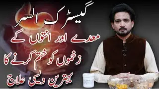 Stomach ulcer ka Ilaj | Meday main dard ka ilaj | Gastric ulcer ka Ilaj | Maday ki jalan ka ilaj