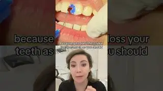 Я не пользуюсь зубной нитью. Что может случиться?!