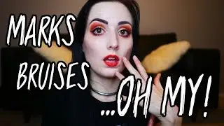 HOW TO GET BETTER MARKS: Bruises, Masochism and More in BDSM