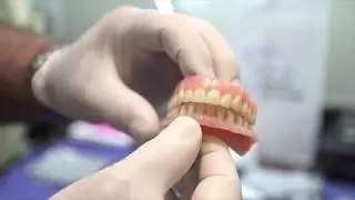 Dental Implants For Veteran in Vista, CA