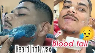 #Beard hair pulling #Pleasure skin beauty skin care men #shave waxing #hotwaxing remove body waxing