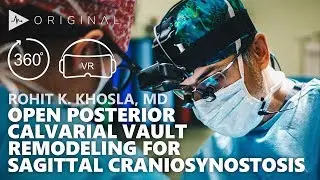 Open Posterior Calvarial Vault Remodeling for Sagittal Craniosynostosis - Dr. Rohit Khosla