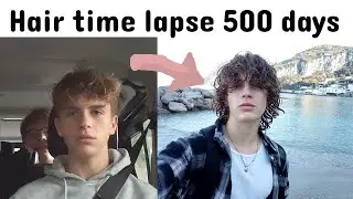 TIME LAPSE - 500 Days Hair Growth