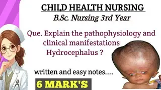 Pathophysiology of Hydrocephalus ! Clinical manifestation of Hydrocephalus ! Paediatrics B.Sc& GNM