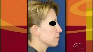 Cleveland Plastic Surgeon Offers a Myriad of Cosmetic Servic