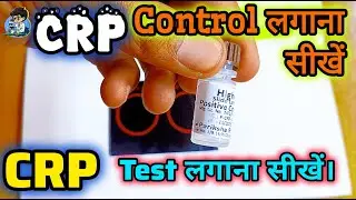 CRP Qualitative Test और Control कैसे लगाते हैं।🩸 in hindi |CRP Test| Quantitative test| #test #viral