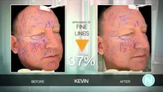 Nerium Skin Care | Nerium Results