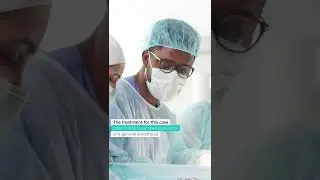 Varicose Veins Treatment