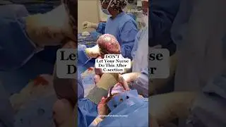 Don&rsquo;t ❌ Let Your Nurse Do THIS After C-Section! #csection