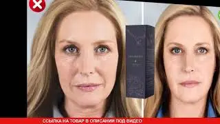 Skin Matrix - обзор препарата