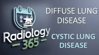 Diffuse Lung Disease: Cystic Lung Disease
