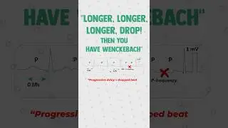 Heart Blocks made easy with this Poem 🫀✍️#medstudent #medschool  #usmlestep1 #usmle #cardiology