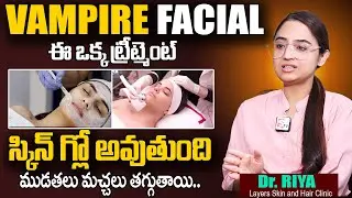 SHOCKING results with This facial || VAMPIRE FACIAL | Face PRP with Microneedling | Glowing Skin