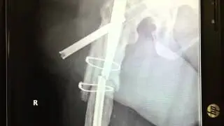 Hardware malfunction