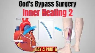 D5 P6,Inner Healing, session 2 ഏറ്റവും വലിയ ബൈപ്പാസ് സർജറി !  (God's Bypass Surgery)